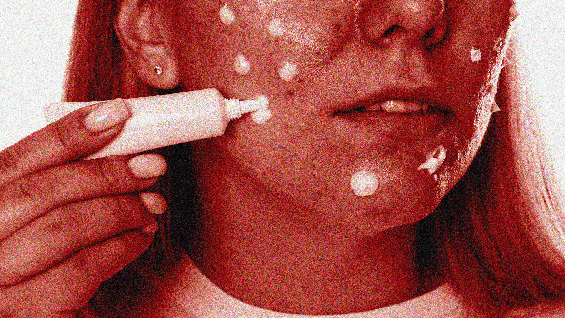 Differin Acne Treatment Benzene Settlement Header Image
