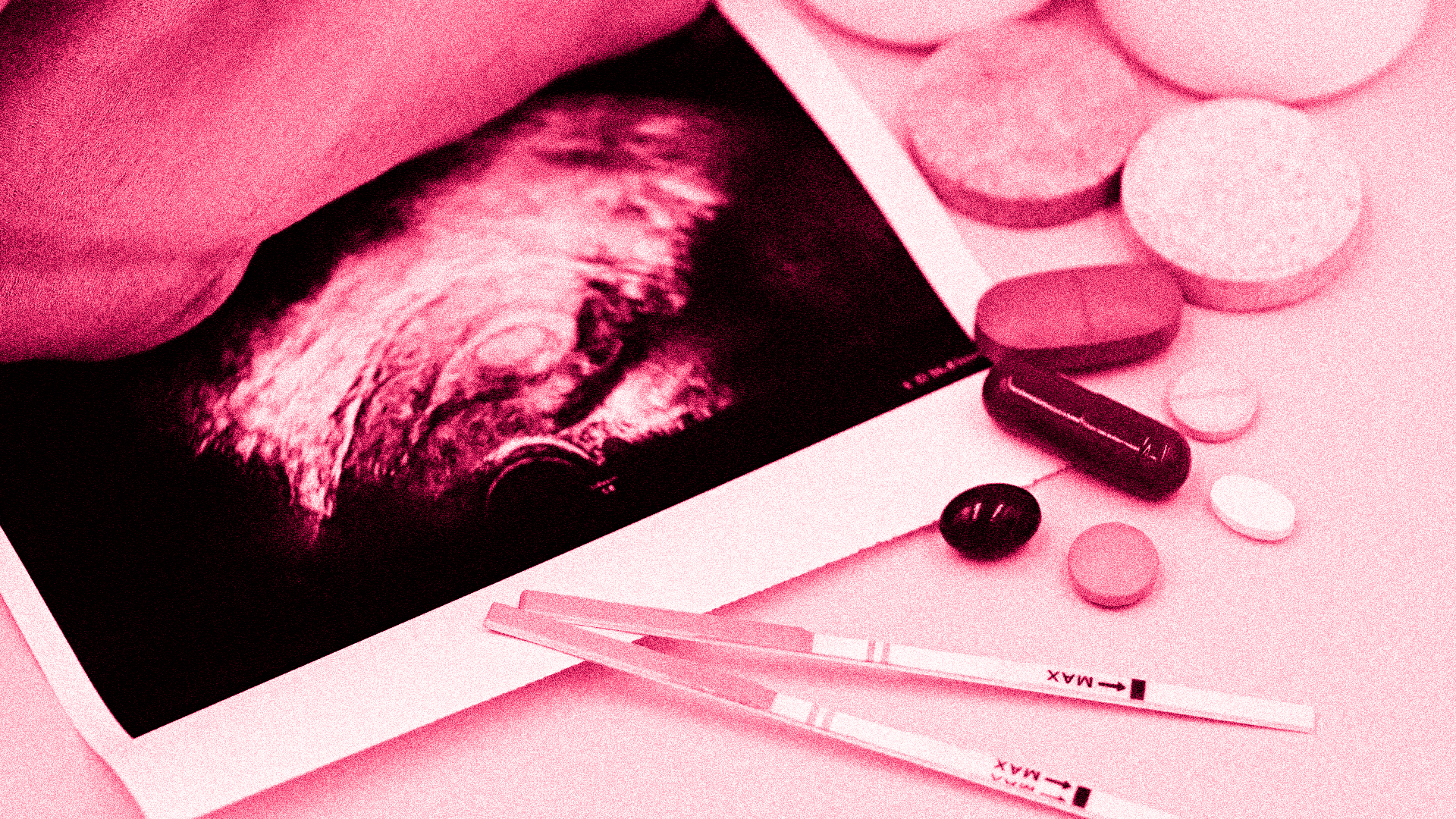 Natera Prenatal Genetic Screening Settlement Header Image